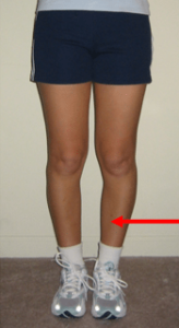 Relieve Shin Splints with Orthotics PTI Orthotics Boulder