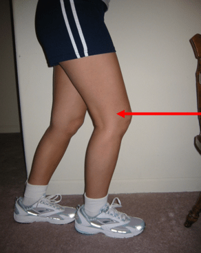 Iliotibial Band Syndrome