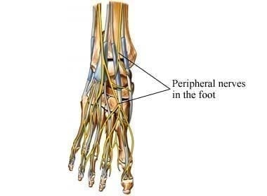 Aids & Peripheral Neuropathy