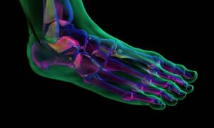 custom-made orthotics