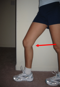 Pes Anserine Bursitis | Knee Pain | PTI Orthotics | Boulder Longmont
